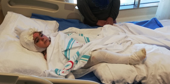 2 yaşındaki Eylül annesinin ekmek pişirdiği tandıra düştü