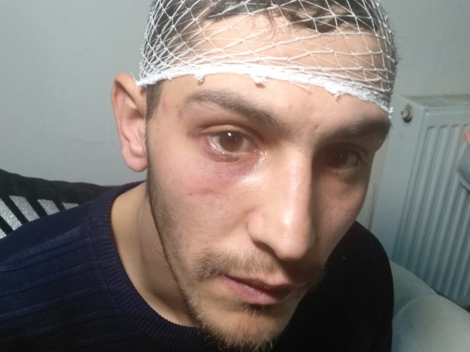 İş aramak için gittiği bölgede önce darp, ardından da gasp edildi 